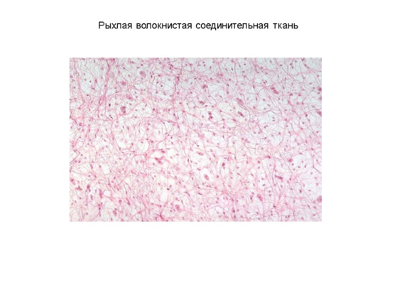 Рыхлая волокнистая соединительная ткань